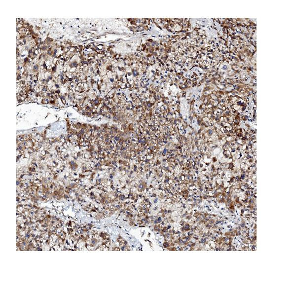 VAPB Antibody in Immunohistochemistry (Paraffin) (IHC (P))