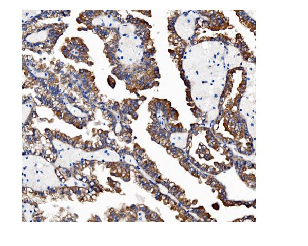 VAPB Antibody in Immunohistochemistry (Paraffin) (IHC (P))