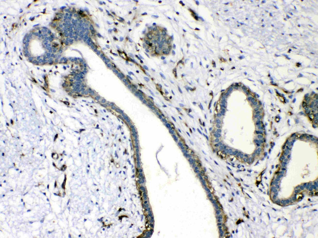 VASP Antibody in Immunohistochemistry (Paraffin) (IHC (P))