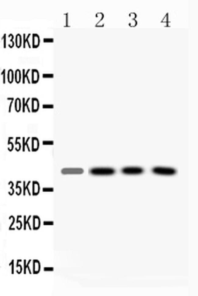 VASP Antibody in Western Blot (WB)