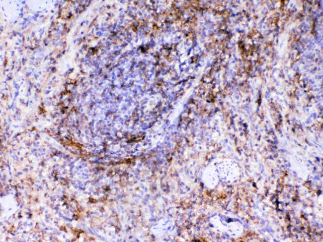 VCAM-1 (CD106) Antibody in Immunohistochemistry (Paraffin) (IHC (P))