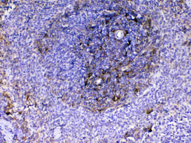 VCAM-1 (CD106) Antibody in Immunohistochemistry (Paraffin) (IHC (P))