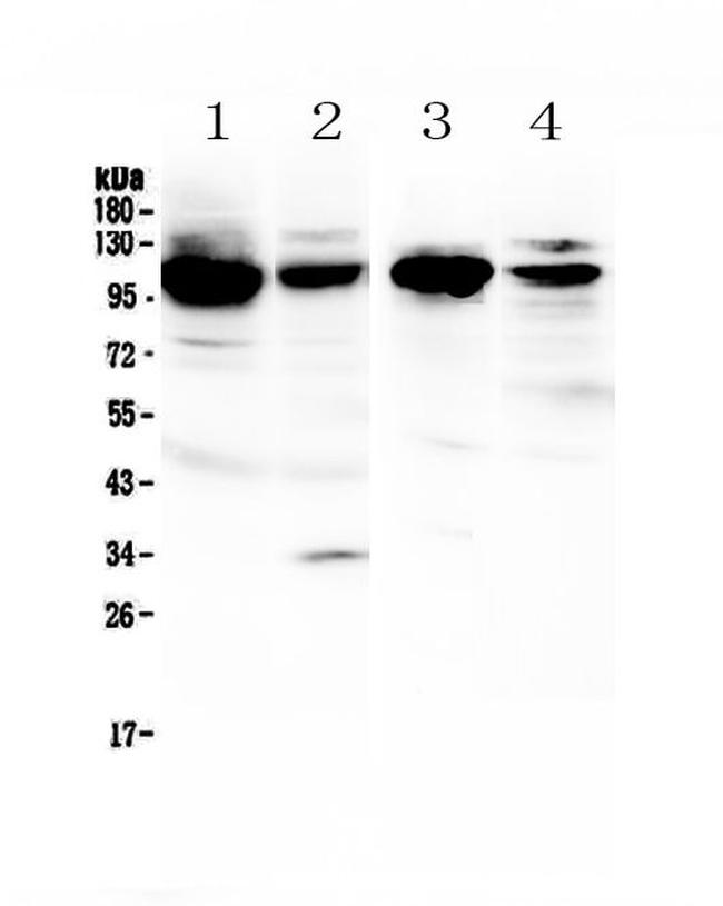 VCAM-1 (CD106) Antibody in Western Blot (WB)