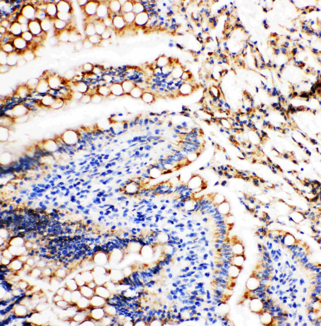 Vinculin Antibody in Immunohistochemistry (Paraffin) (IHC (P))