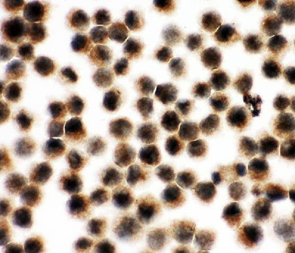 VCP Antibody in Immunocytochemistry (ICC/IF)