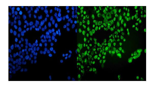 VCP Antibody in Immunocytochemistry (ICC/IF)