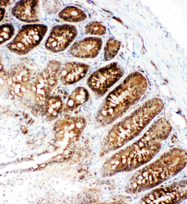 VCP Antibody in Immunohistochemistry (Frozen) (IHC (F))