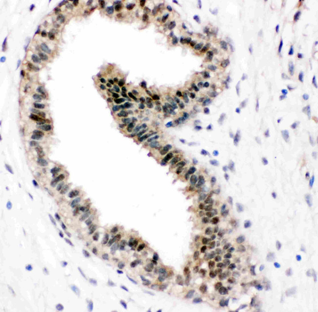 VCP Antibody in Immunohistochemistry (Paraffin) (IHC (P))