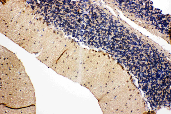 VCP Antibody in Immunohistochemistry (Paraffin) (IHC (P))