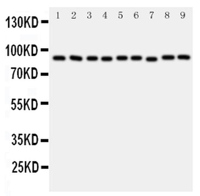 VCP Antibody in Western Blot (WB)