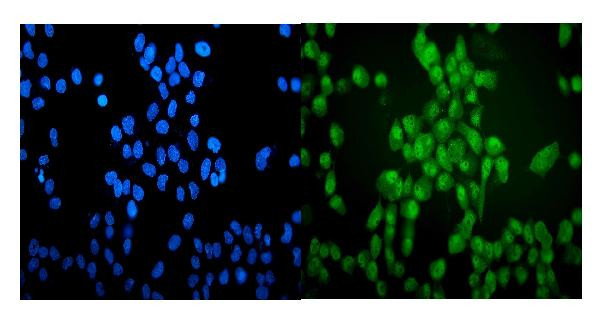 VCP Antibody in Immunocytochemistry (ICC/IF)