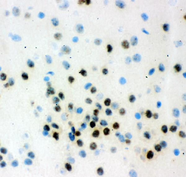 VCP Antibody in Immunohistochemistry (Frozen) (IHC (F))