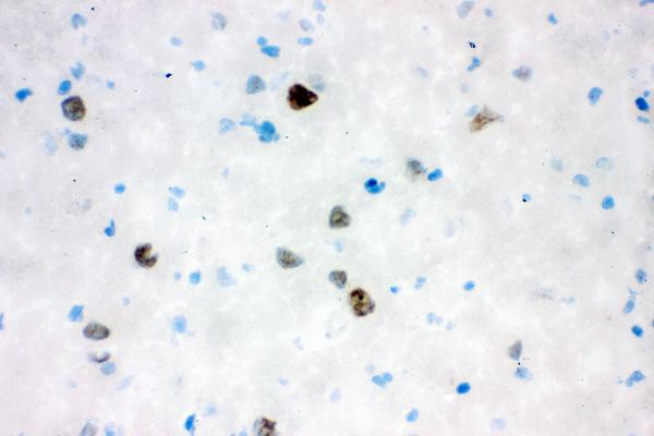 VCP Antibody in Immunohistochemistry (Frozen) (IHC (F))