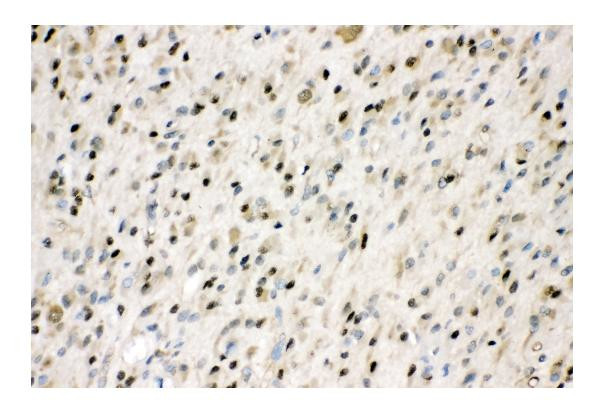 VCP Antibody in Immunohistochemistry (Paraffin) (IHC (P))