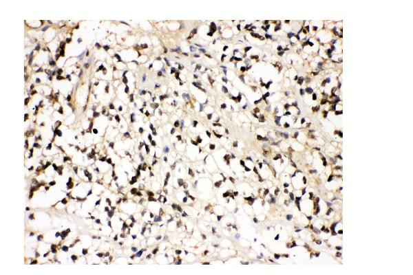 VCP Antibody in Immunohistochemistry (Paraffin) (IHC (P))