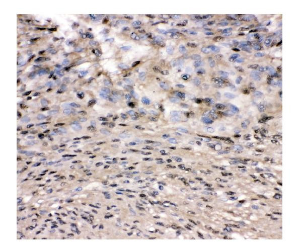 VCP Antibody in Immunohistochemistry (Paraffin) (IHC (P))