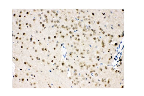 VCP Antibody in Immunohistochemistry (Paraffin) (IHC (P))