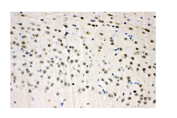 VCP Antibody in Immunohistochemistry (Paraffin) (IHC (P))