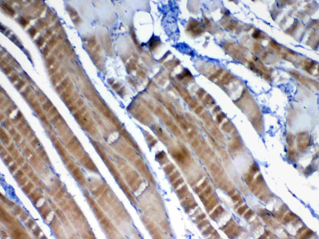 VEGFB Antibody in Immunohistochemistry (Paraffin) (IHC (P))