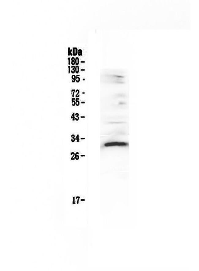 VEGFB Antibody in Western Blot (WB)