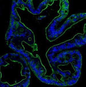 Villin Antibody in Immunohistochemistry (Paraffin) (IHC (P))