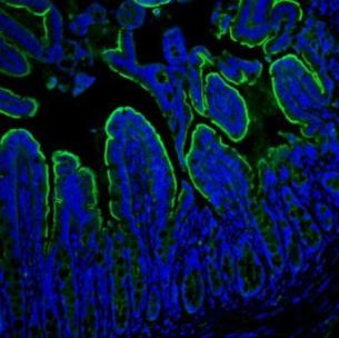 Villin Antibody in Immunohistochemistry (Paraffin) (IHC (P))