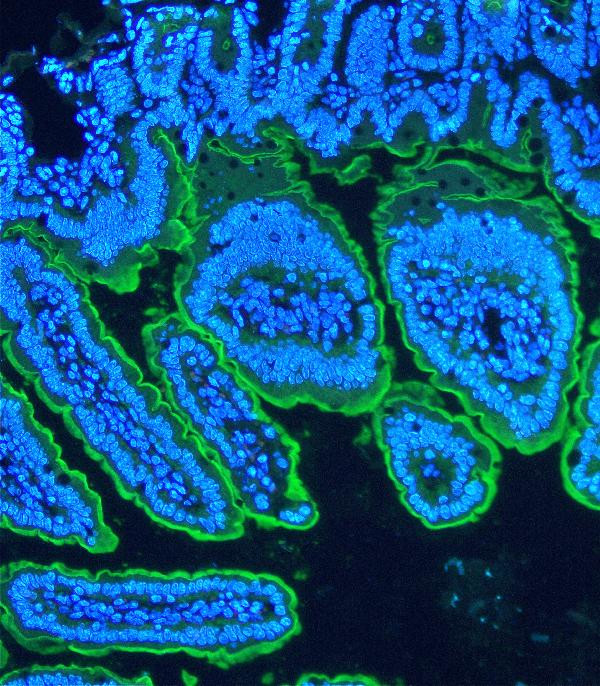 Villin Antibody in Immunohistochemistry (Paraffin) (IHC (P))