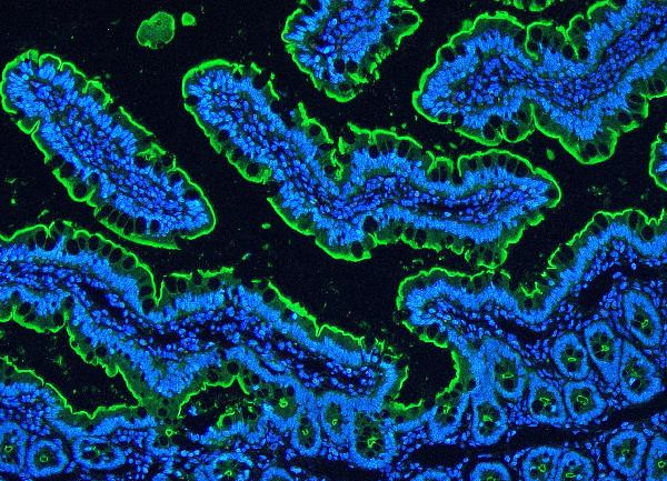 Villin Antibody in Immunohistochemistry (Paraffin) (IHC (P))