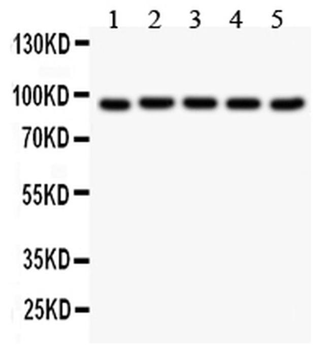 Villin Antibody in Western Blot (WB)