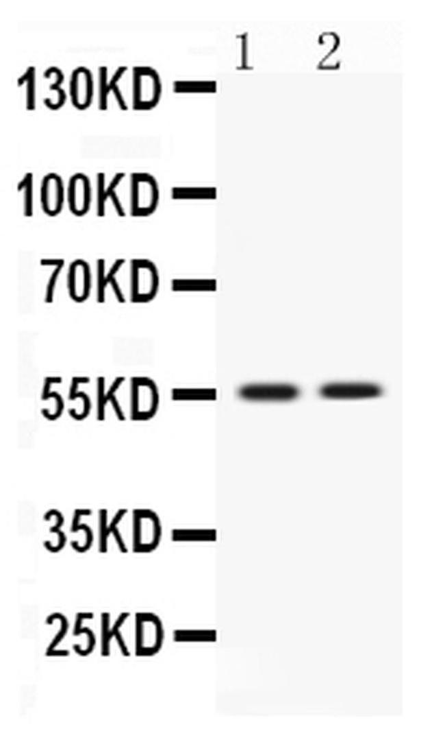 VRK1 Antibody in Western Blot (WB)