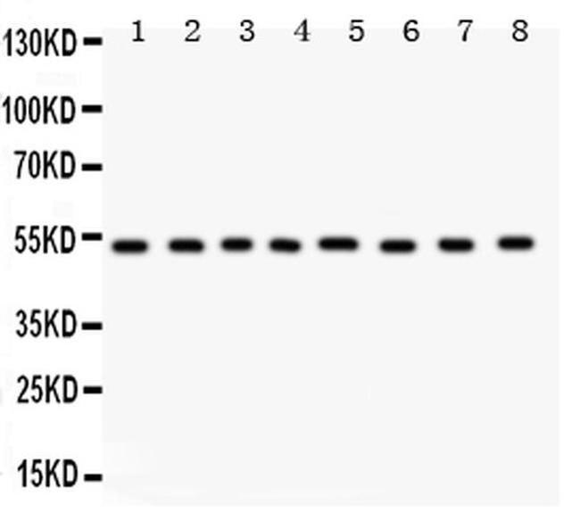 WASP Antibody in Western Blot (WB)