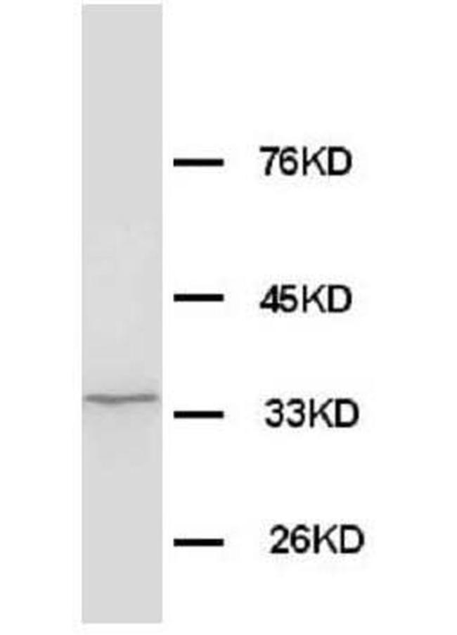 MORG1 Antibody in Western Blot (WB)