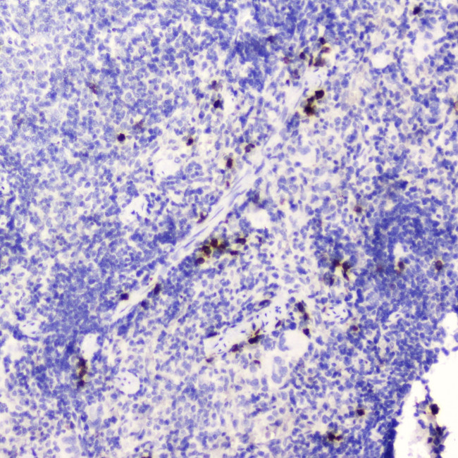 WFDC2 Antibody in Immunohistochemistry (Paraffin) (IHC (P))