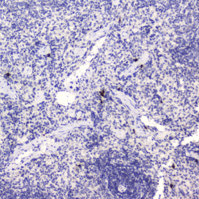 WFDC2 Antibody in Immunohistochemistry (Paraffin) (IHC (P))