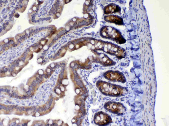 WFDC2 Antibody in Immunohistochemistry (Paraffin) (IHC (P))