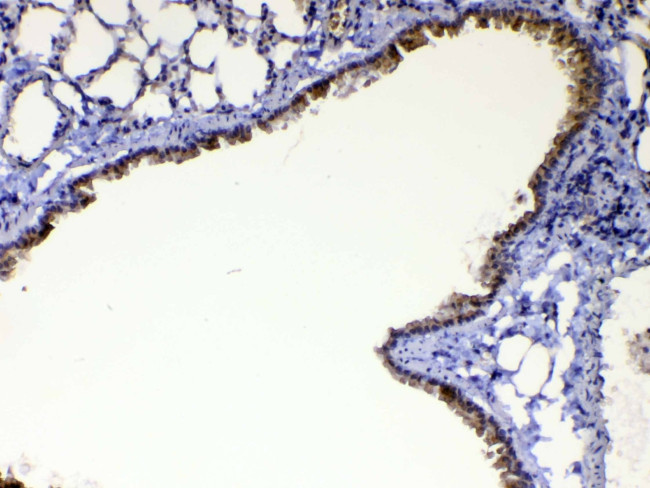 WFDC2 Antibody in Immunohistochemistry (Paraffin) (IHC (P))