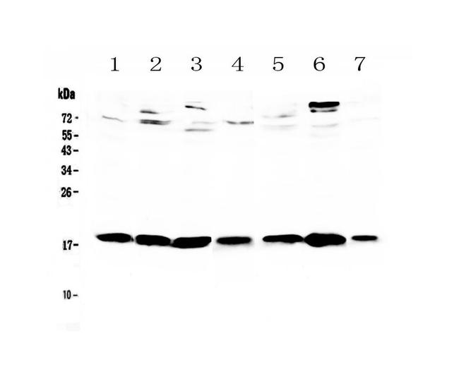 WFDC2 Antibody in Western Blot (WB)