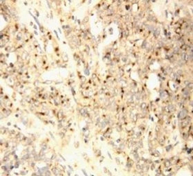 XAF1 Antibody in Immunohistochemistry (Paraffin) (IHC (P))