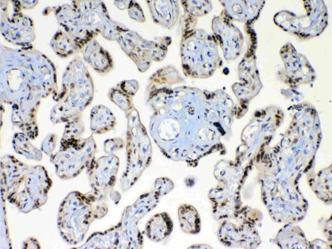 XRCC1 Antibody in Immunohistochemistry (Paraffin) (IHC (P))