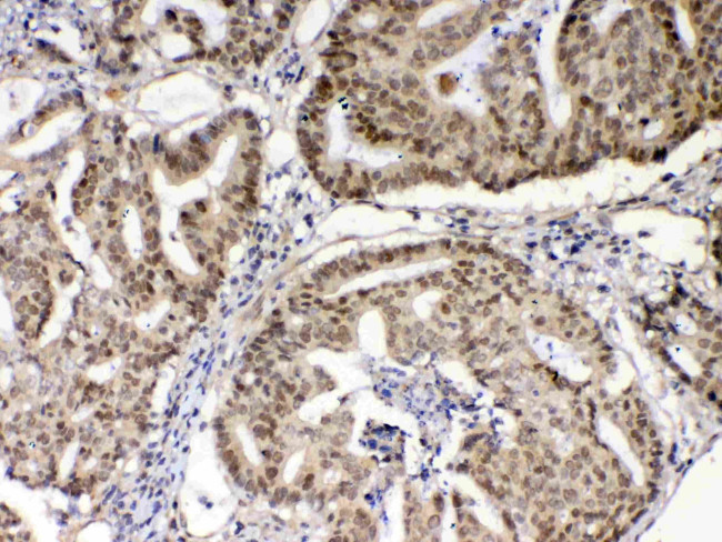 XRCC1 Antibody in Immunohistochemistry (Paraffin) (IHC (P))