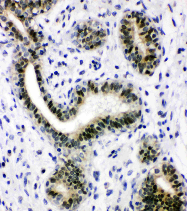 XRCC1 Antibody in Immunohistochemistry (Paraffin) (IHC (P))