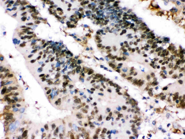 XRCC4 Antibody in Immunohistochemistry (Paraffin) (IHC (P))