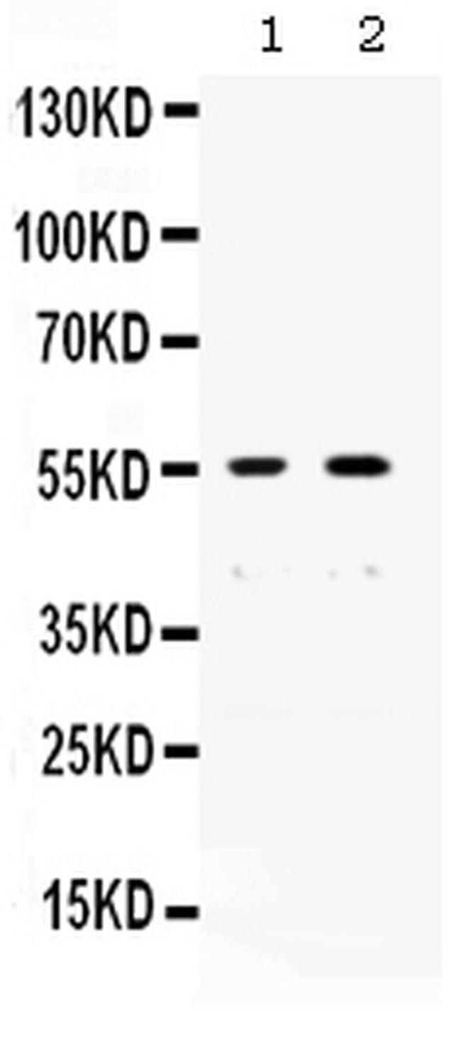 XRCC4 Antibody in Western Blot (WB)