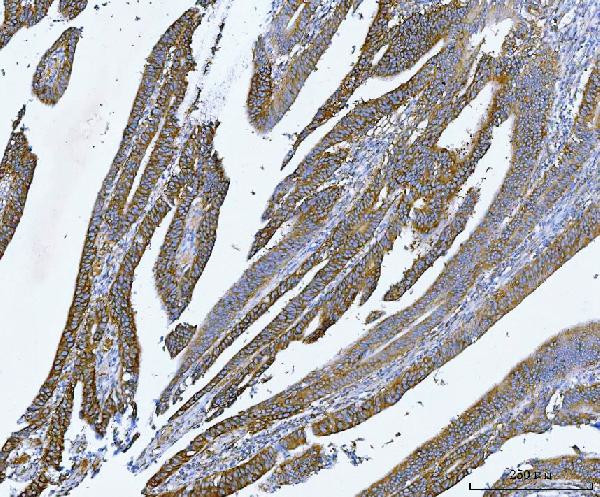 YBX1 Antibody in Immunohistochemistry (Paraffin) (IHC (P))