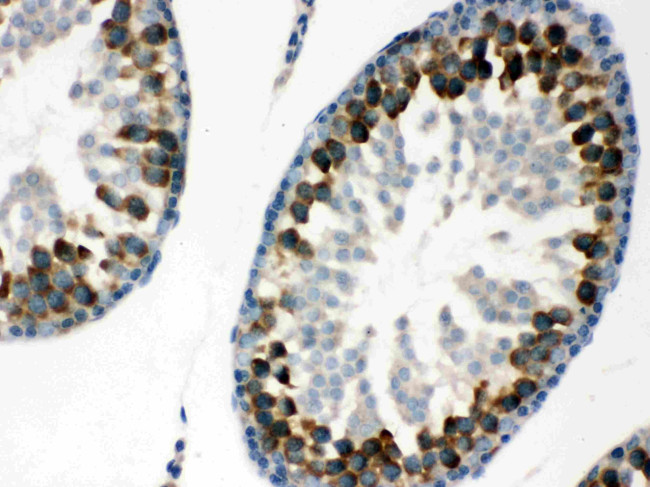 YBX1 Antibody in Immunohistochemistry (Paraffin) (IHC (P))