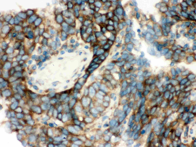 YBX1 Antibody in Immunohistochemistry (Paraffin) (IHC (P))