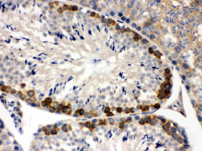 YBX1 Antibody in Immunohistochemistry (Paraffin) (IHC (P))