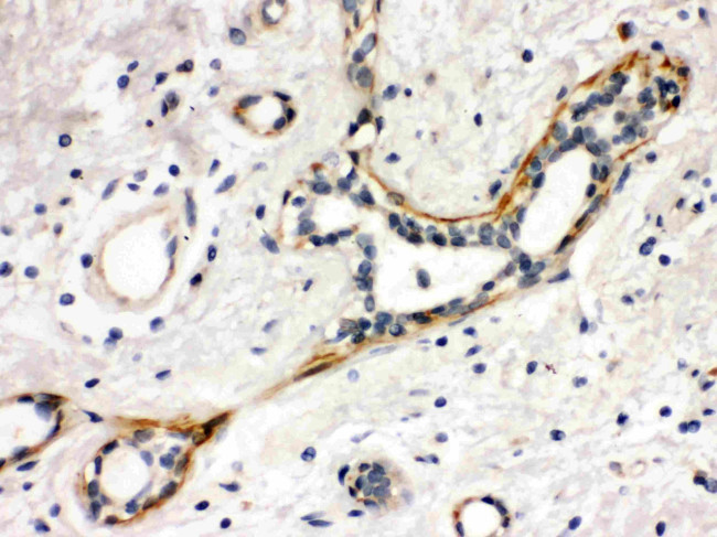 YES1 Antibody in Immunohistochemistry (Paraffin) (IHC (P))