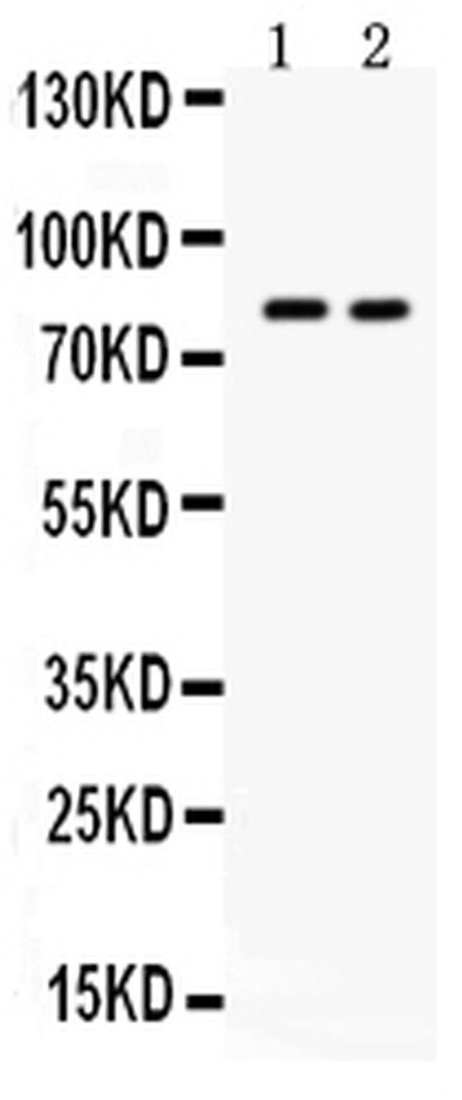 ZP2 Antibody in Western Blot (WB)