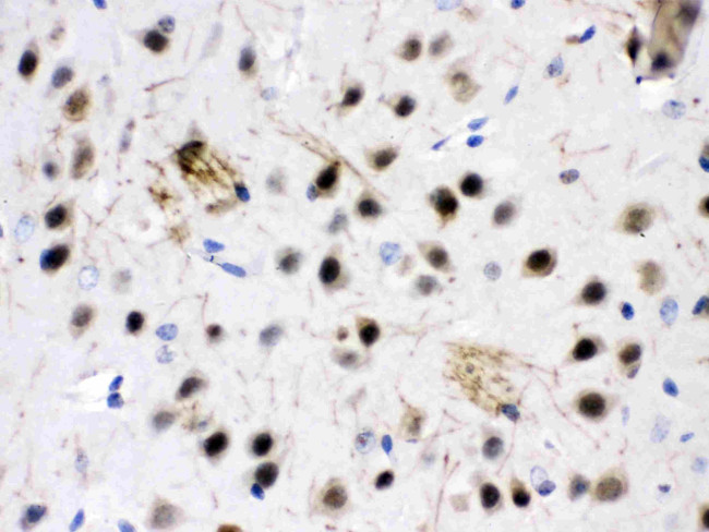 ZWINT Antibody in Immunohistochemistry (Paraffin) (IHC (P))